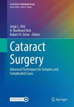 Cataract Surgery Advanced Techniques for Complex and Complicated Cases