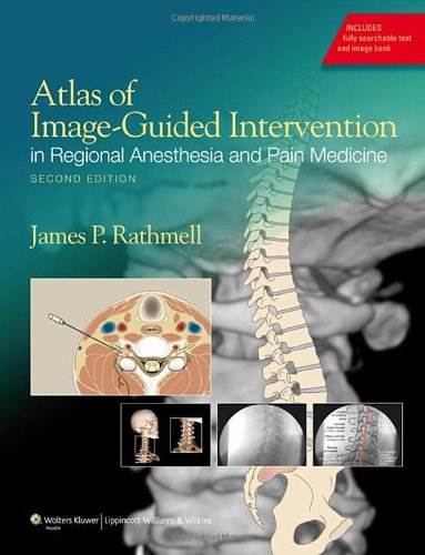 Atlas of Image Guided Intervention in Regional Anesthesia and Pain Medicine