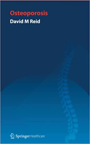 Handbook of Osteoporosis