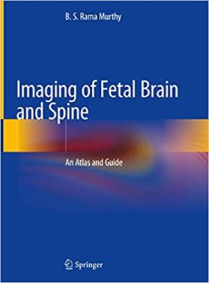 Imaging of Fetal Brain and Spine An Atlas and Guide