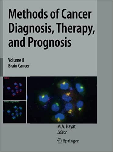 Methods of Cancer Diagnosis Therapy and Prognosis Volume 8 Brain Cancer