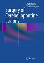 Surgery of Cerebellopontine Lesions