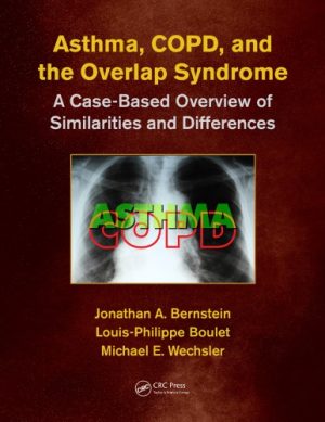 Asthma COPD and Overlap A Case Based Overview of Similarities and Differences