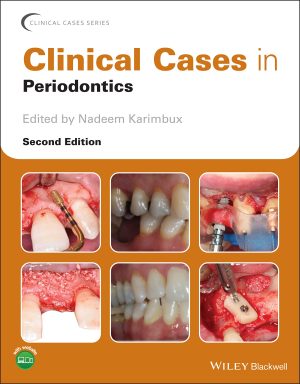 Clinical Cases in Periodontics 2nd Edition