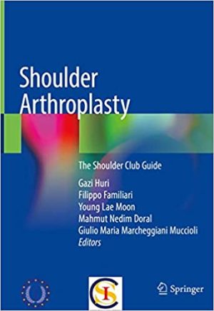 Shoulder Arthroplasty The Shoulder Club Guide