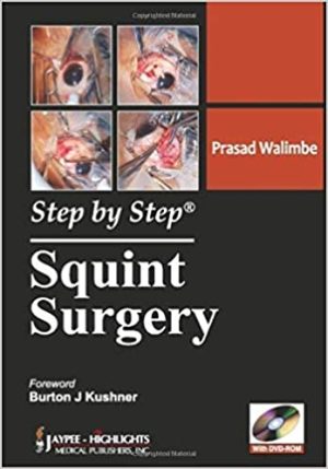 Step by Step Squint Surgery