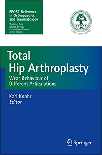 Total Hip Arthroplasty Wear Behaviour of Different Articulations