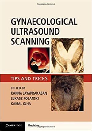 Gynaecological Ultrasound Scanning Tips and Tricks