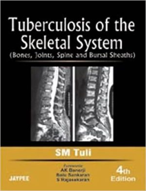 Tuberculosis of the Skeletal System Bones Joints Spine and Bursal Sheaths 4th Edition