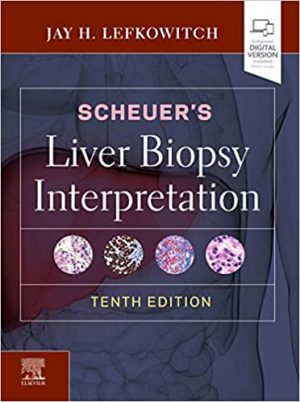 Scheuers Liver Biopsy Interpretation 10th Ed
