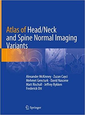 Atlas of Head Neck and Spine Normal Imaging Variants