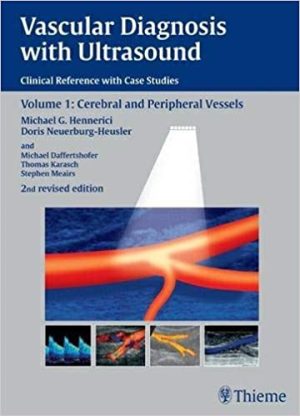 Vascular Diagnosis with Ultrasound Clinical Reference with Case Studies Volume 1 Cerebral and Peripheral Vessels