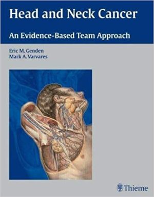 Head and Neck Cancer An Evidence Based Team Approach