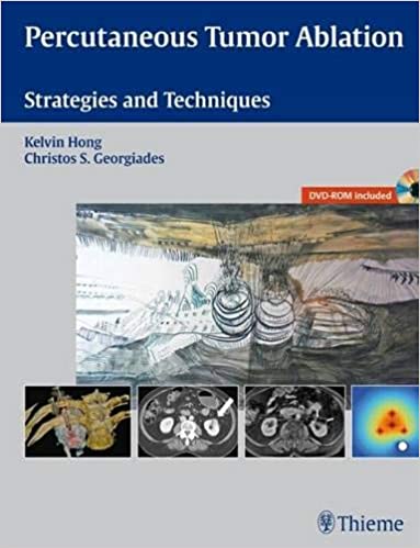 Percutaneous Tumor Ablation Strategies and Techniques