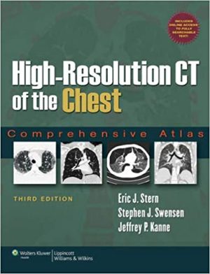 High Resolution CT of the Chest Comprehensive Atlas