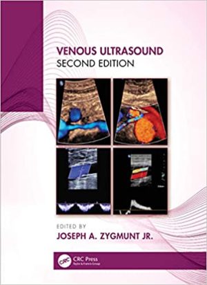 Venous Ultrasound 2nd Edition