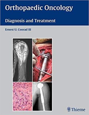 Orthopaedic Oncology Diagnosis and Treatment