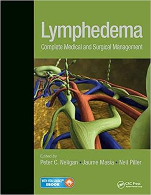 Lymphedema Complete Medical and Surgical Management
