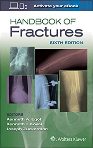 Handbook of Fractures 6th Edition