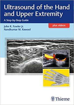 Ultrasound of the Hand and Upper Extremity A Step By Step Guide