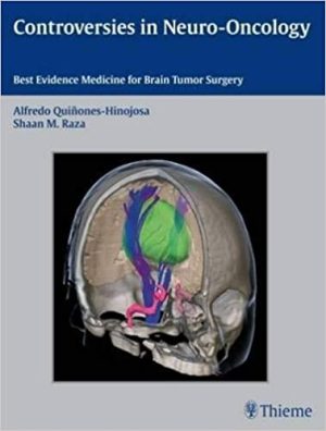 Controversies in Neuro Oncology Best Evidence Medicine for Brain Tumor Surgery
