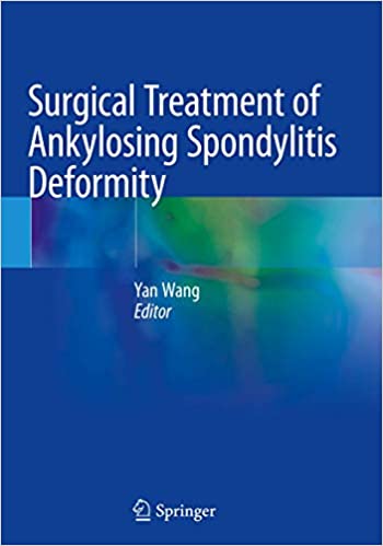 Surgical Treatment of Ankylosing Spondylitis Deformity