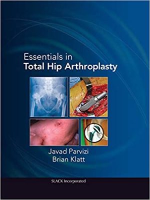 Essentials in Total Hip Arthroplasty