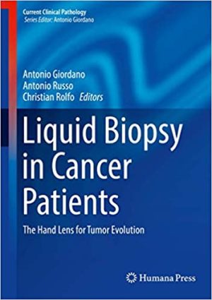Liquid Biopsy in Cancer Patients The Hand Lens for Tumor Evolution