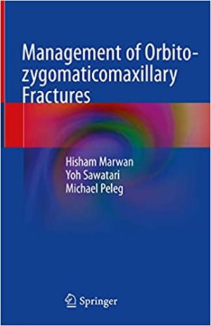 Management of Orbito Zygomaticomaxillary Fractures