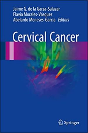 Cervical Cancer