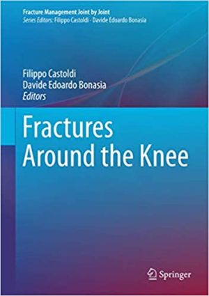 Fractures Around the Knee