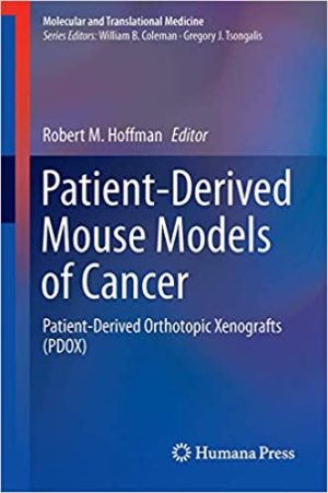 Patient Derived Mouse Models of Cancer Patient Derived Orthotopic Xenografts (PDOX)