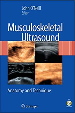 Musculoskeletal Ultrasound Anatomy and Technique