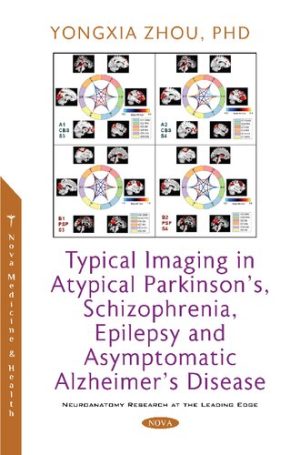 Typical Imaging In Atypical Parkinsons Schizophrenia Epilepsy And Asymptomatic Alzheimers Disease