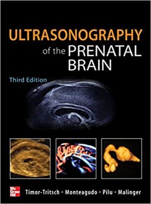 Ultrasonography of the Prenatal Brain 3rd Edition