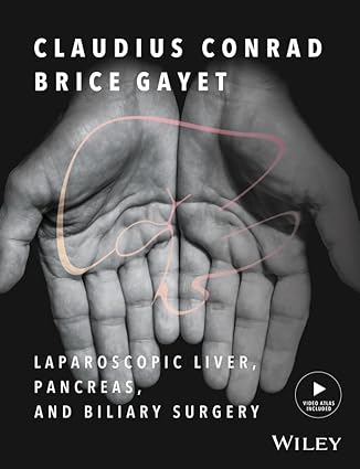 Laparoscopic Liver Pancreas and Biliary Surgery