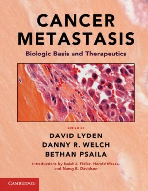 Cancer Metastasis Biologic Basis and Therapeutics
