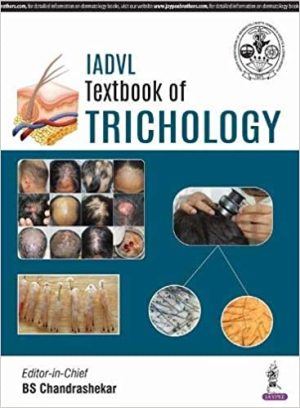 IADVL Textbook of Trichology