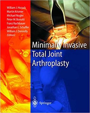 Minimally Invasive Total Joint Arthroplasty
