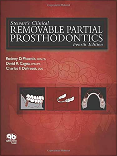 Stewarts Clinical Removable Partial Prosthodontics 4th Edition