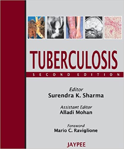 Tuberculosis 2nd Edition