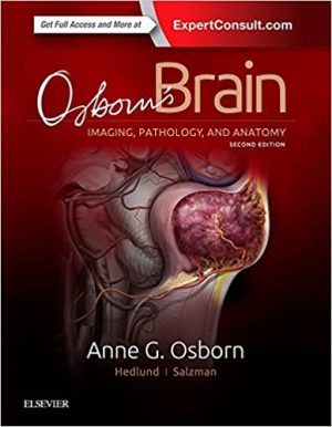 Osborns Brain imaging Pathology And Anatomy 2nd Edition