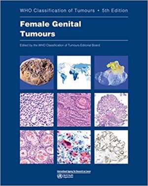 WHO Classification of Tumours Female Genital Tumours 5th Edition