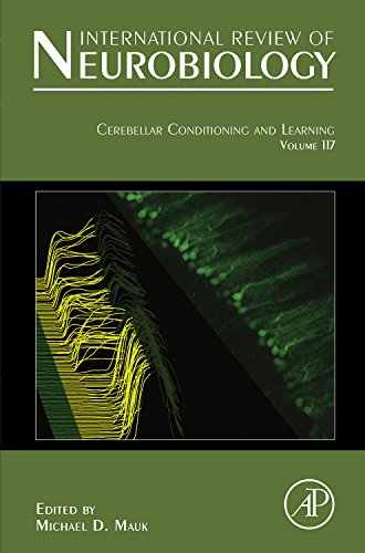 Cerebellar Conditioning and Learning