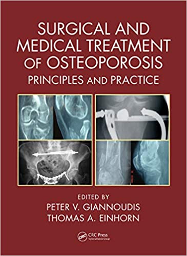 Surgical and Medical Treatment of Osteoporosis Principles and Practice