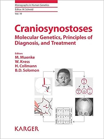 Craniosynostoses Molecular Genetic Principles of Diagnosis and Treatment