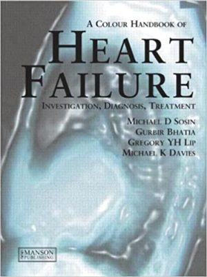 A Colour Handbook of Heart Failure Diagnosis Investigation Treatment
