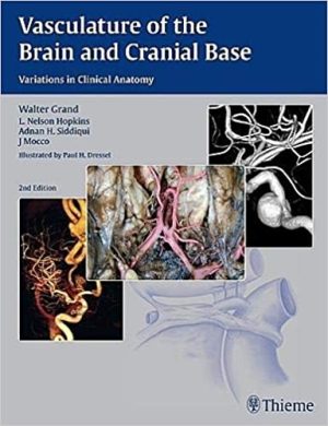 Vasculature Of The Brain And Cranial Base Variations in Clinical Anatomy 2nd Ed