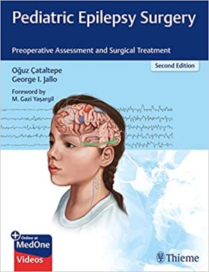Pediatric Epilepsy Surgery Preoperative Assessment and Surgical Treatment 2nd Edition