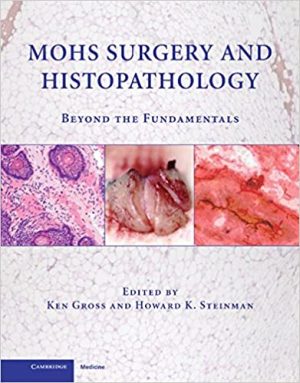Mohs Surgery and Histopathology Beyond the Fundamentals